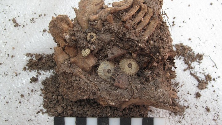 Uno scavo rivelatorio: lo scavo in Lazarides, Εgina dove si è scoperto lo scheletro di una ragazzina con sindrome Down, l’unico questo reperto trovato finora in Grecia
